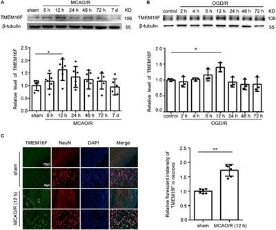 TMEM16F Aggravates Neuronal Loss by Mediating Microglial Phagocytosis of Neurons in a Rat Experimental Cerebral Ischemia and Reperfusion Model